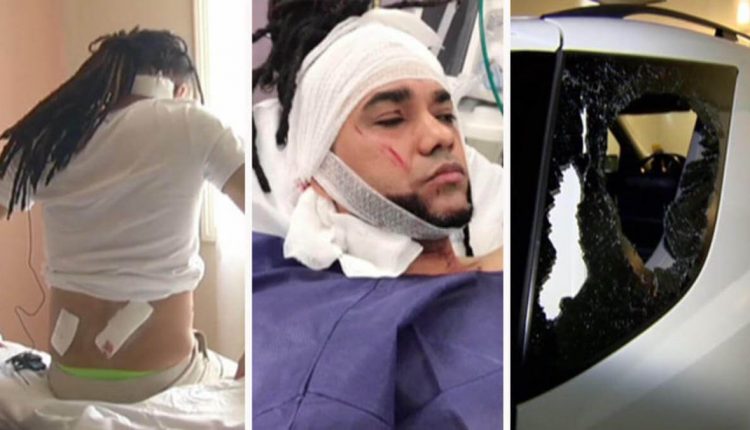 merenguero Javier Gutiérrez mala herido
