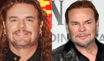 El vocalista de maná se somete a cirugía plástica