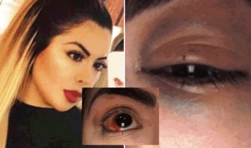 Golpean A Paola Villalobos En Un Antro De La Ciudad De México