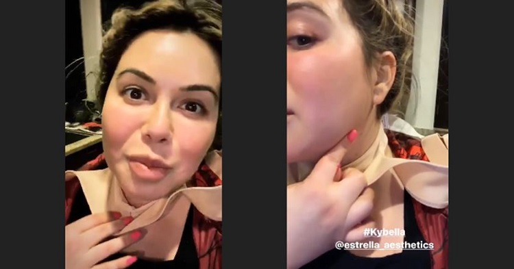 Chiquis Rivera explicó su tratamiento para reducir papada y grasa del cuello a través de sus historias en Instagram 