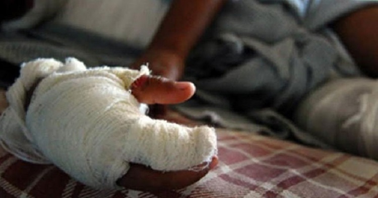 Dos niñas permanecen hospitalizadas por las quemaduras que sufrieron, pero el pequeño de 7 años perdió la vida a causa de sus lesiones por el fuego